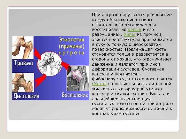 При артрозе нарушается равновесие между образованием нового строительного материала для восстановления хряща и его