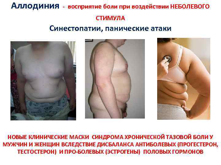 Аллодиния - восприятие боли при воздействии НЕБОЛЕВОГО СТИМУЛА Синестопатии, панические атаки НОВЫЕ КЛИНИЧЕСКИЕ МАСКИ