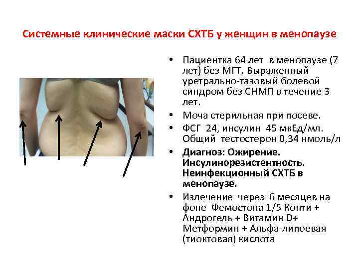 Системные клинические маски СХТБ у женщин в менопаузе • Пациентка 64 лет в менопаузе