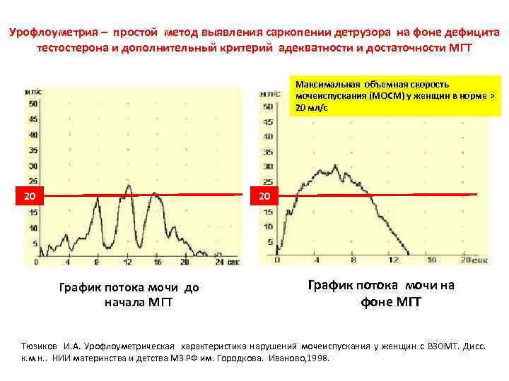 Что такое урофлоуметрия. Урофлоуметрия интерпретация результатов. Результаты урофлоуметрии расшифровка. Урофлоуметрия нормальные показатели у женщин. Урофлоуметрия показатели нормы у мужчин.