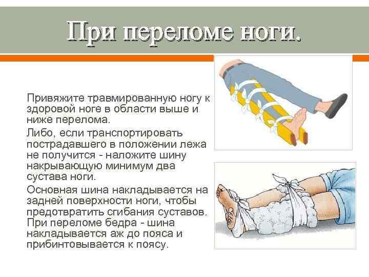 При переломе ноги. Привяжите травмированную ногу к здоровой ноге в области выше и ниже