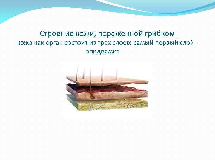 Строение кожи, пораженной грибком кожа как орган состоит из трех слоев: самый первый слой