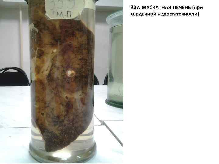 307. МУСКАТНАЯ ПЕЧЕНЬ (при сердечной недостаточности) 