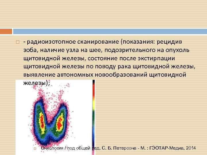 Рецидив папиллярного рака щитовидной. Радиоизотопное сканирование щитовидной железы. Радиоизотопное исследование слюнных желез. Радиоизотопное йодирование.