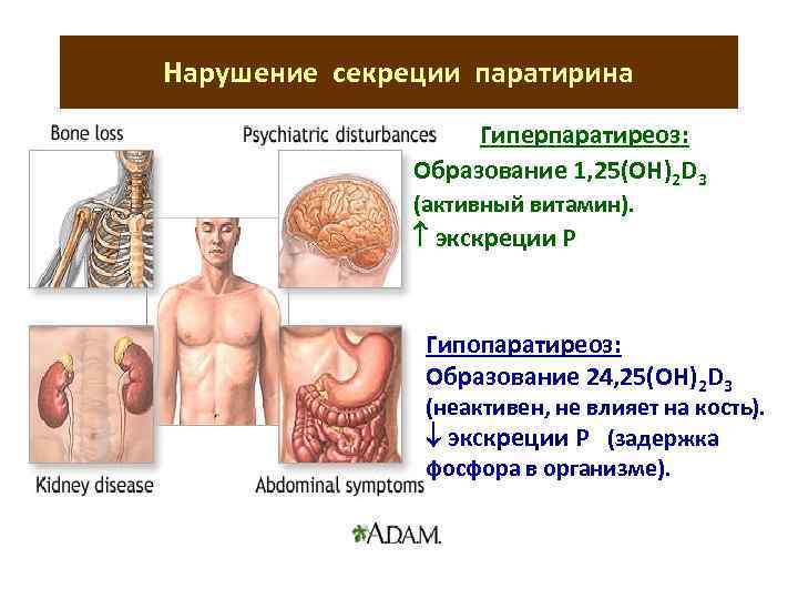 Нарушение секреции паратирина Гиперпаратиреоз: Образование 1, 25(ОН)2 D 3 (активный витамин). экскреции Р Гипопаратиреоз:
