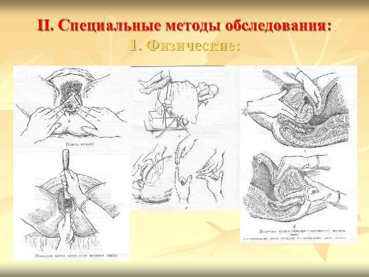II. Специальные методы обследования: 1. Физические: 