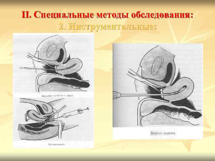 II. Специальные методы обследования: 2. Инструментальные: 