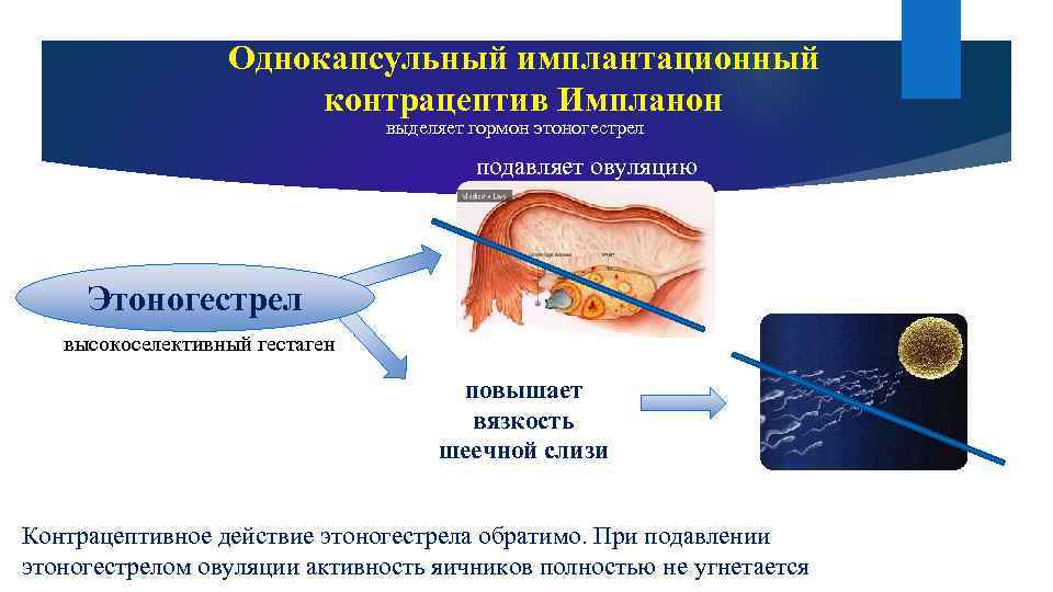 Однокапсульный имплантационный контрацептив Импланон выделяет гормон этоногестрел подавляет овуляцию Этоногестрел высокоселективный гестаген повышает вязкость