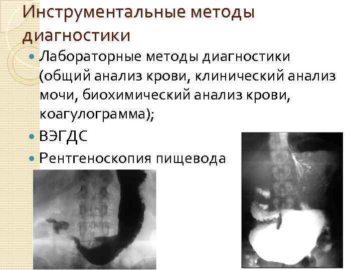 Инструментальные методы диагностики Лабораторные методы диагностики (общий анализ крови, клинический анализ мочи, биохимический анализ