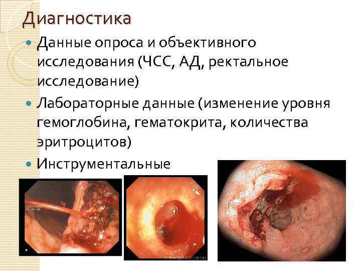 Диагностика Данные опроса и объективного исследования (ЧСС, АД, ректальное исследование) Лабораторные данные (изменение уровня
