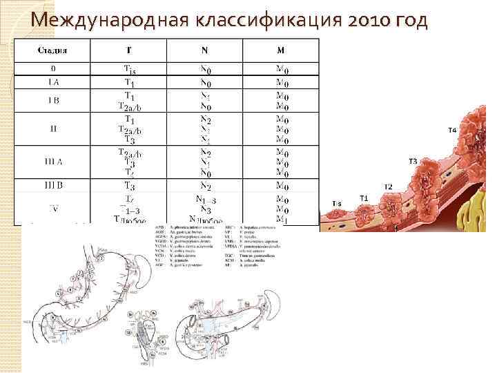 Международная классификация 2010 год 