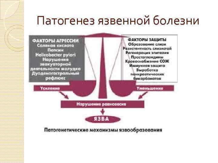 Патогенез язвенной болезни 