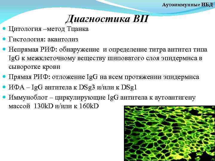 Аутоиммунные ИБД Диагностика ВП Цитология –метод Тцанка Гистология: акантолиз Непрямая РИФ: обнаружение и определение