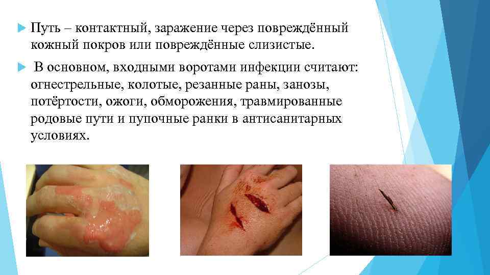  Путь – контактный, заражение через повреждённый кожный покров или повреждённые слизистые. В основном,
