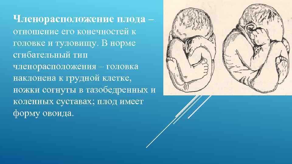 Членорасположение плода – отношение его конечностей к головке и туловищу. В норме сгибательный тип