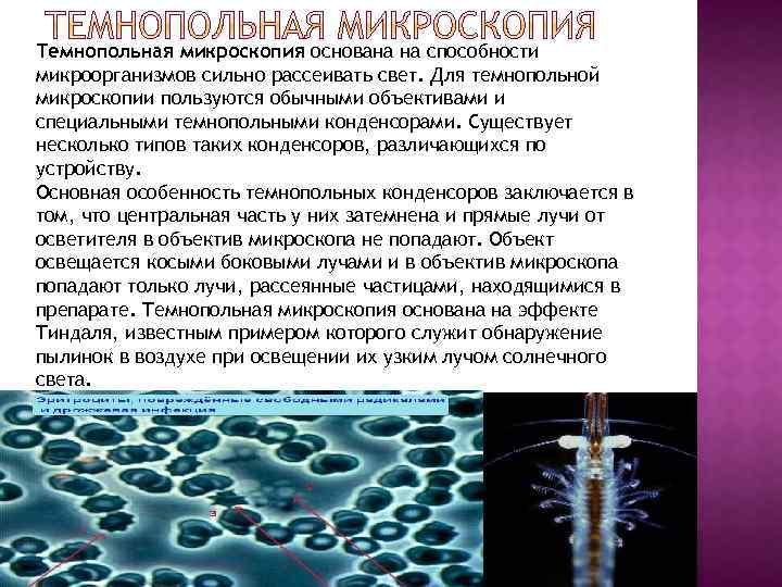 Темнопольная микроскопия основана на способности микроорганизмов сильно рассеивать свет. Для темнопольной микроскопии пользуются обычными