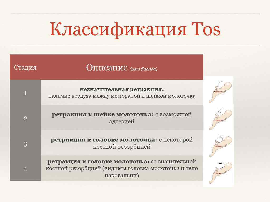 Классификация Tos Стадия Описание (pars flaccida) 1 незначительная ретракция: наличие воздуха между мембраной и