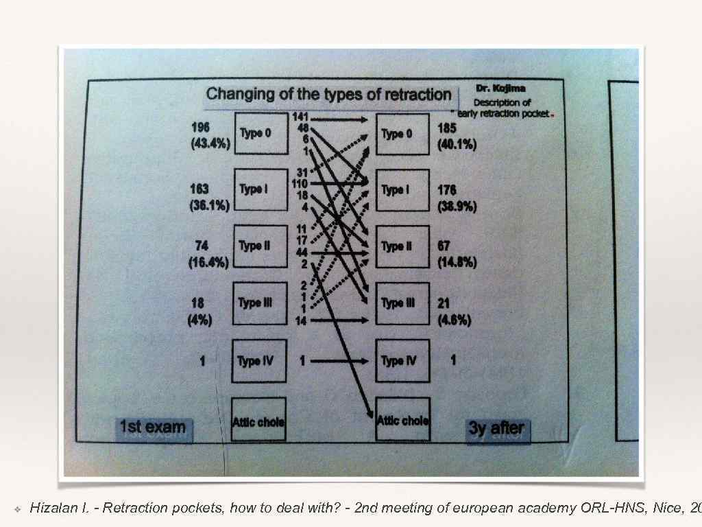 ❖ Hizalan I. - Retraction pockets, how to deal with? - 2 nd meeting