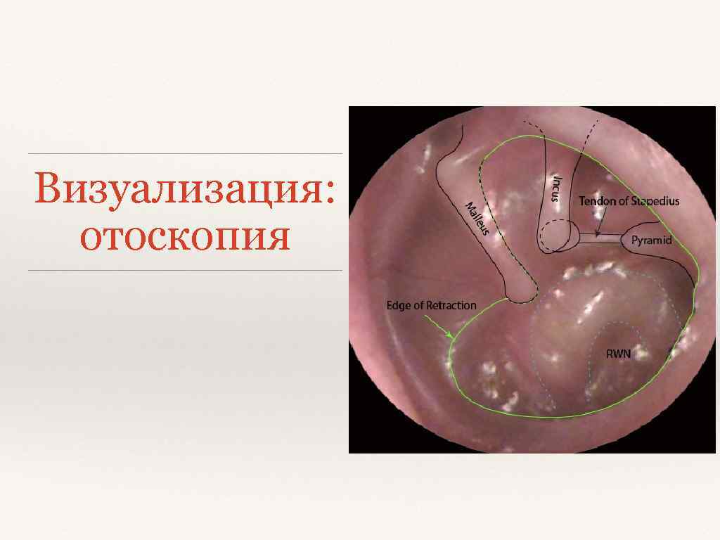 Визуализация: отоскопия 