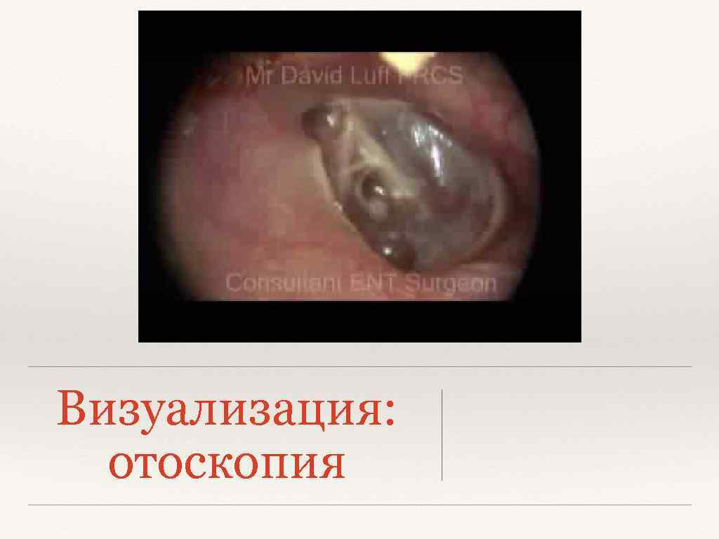 Визуализация: отоскопия 