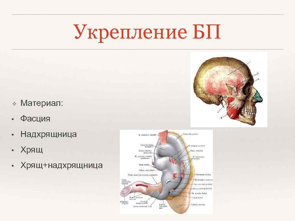 Укрепление БП ❖ Материал: • Фасция • Надхрящница • Хрящ+надхрящница 