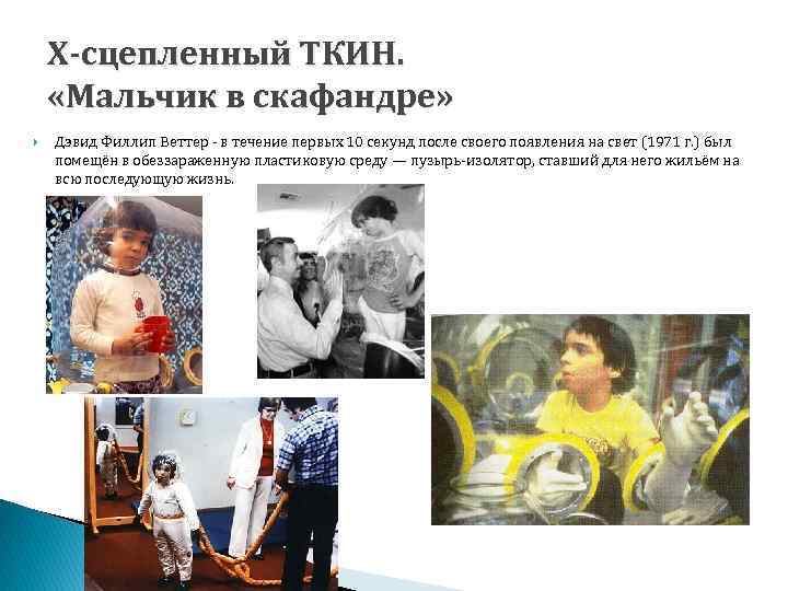 Х-сцепленный ТКИН. «Мальчик в скафандре» Дэвид Филлип Веттер - в течение первых 10 секунд