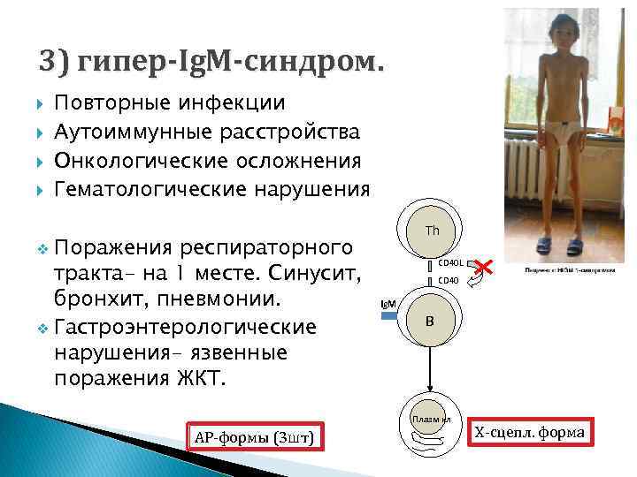 Синдром джоба презентация