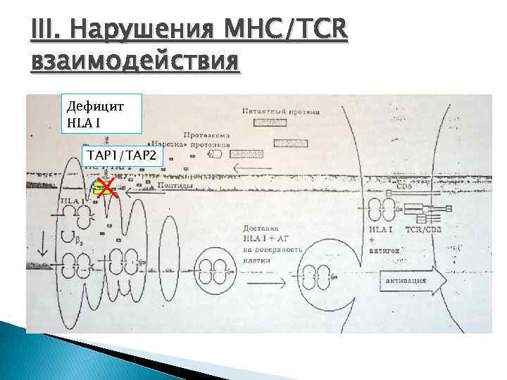 III. Нарушения МНС/TCR взаимодействия Дефицит HLA I TAP 1/TAP 2 