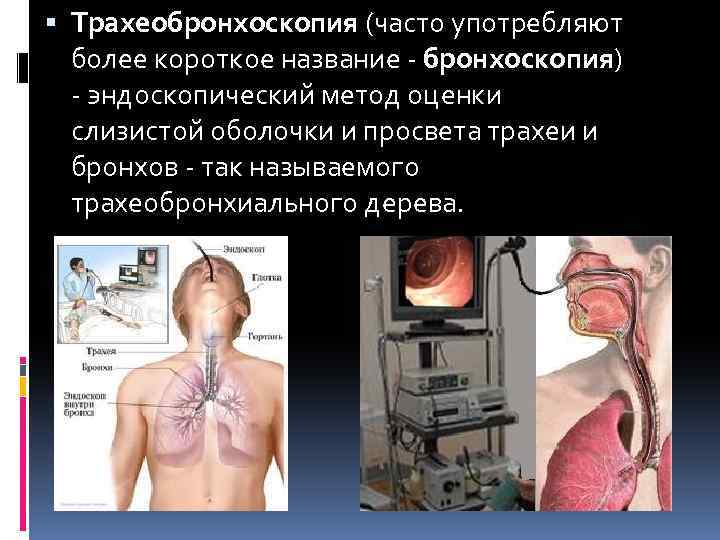 Лечебная бронхоскопия. Бронхоскопия и бронхография. Аспирационная бронхоскопия. Эндоскопическое исследование бронхов.