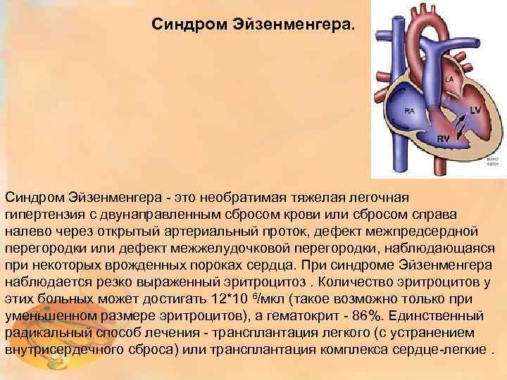 Синдром Эйзенменгера. Синдром Эйзенменгера - это необратимая тяжелая легочная гипертензия с двунаправленным сбросом крови