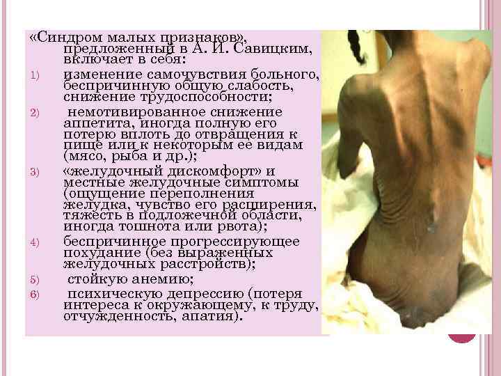  «Синдром малых признаков» , предложенный в А. И. Савицким, включает в себя: 1)