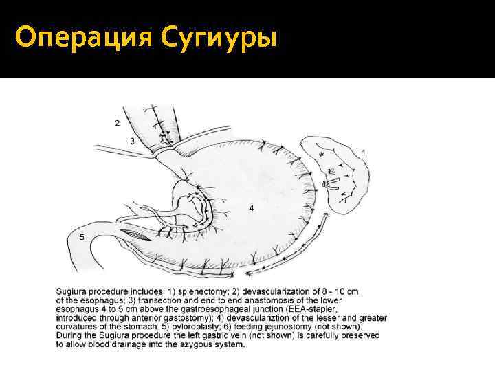 Операция Сугиуры 