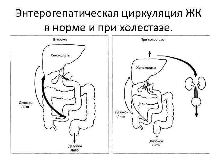 Энтерогепатическая циркуляция ЖК в норме и при холестазе. 