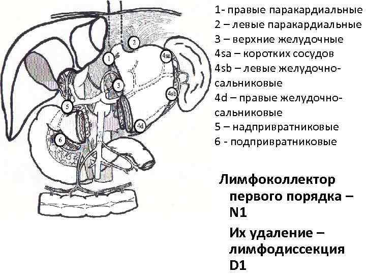 1 - правые паракардиальные 2 – левые паракардиальные 3 – верхние желудочные 4 sa