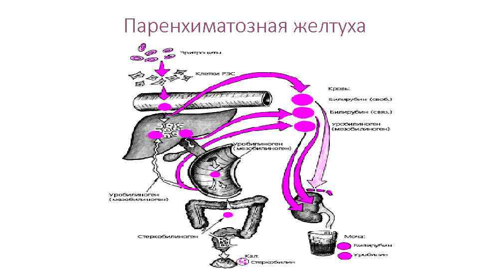 Паренхиматозная желтуха 