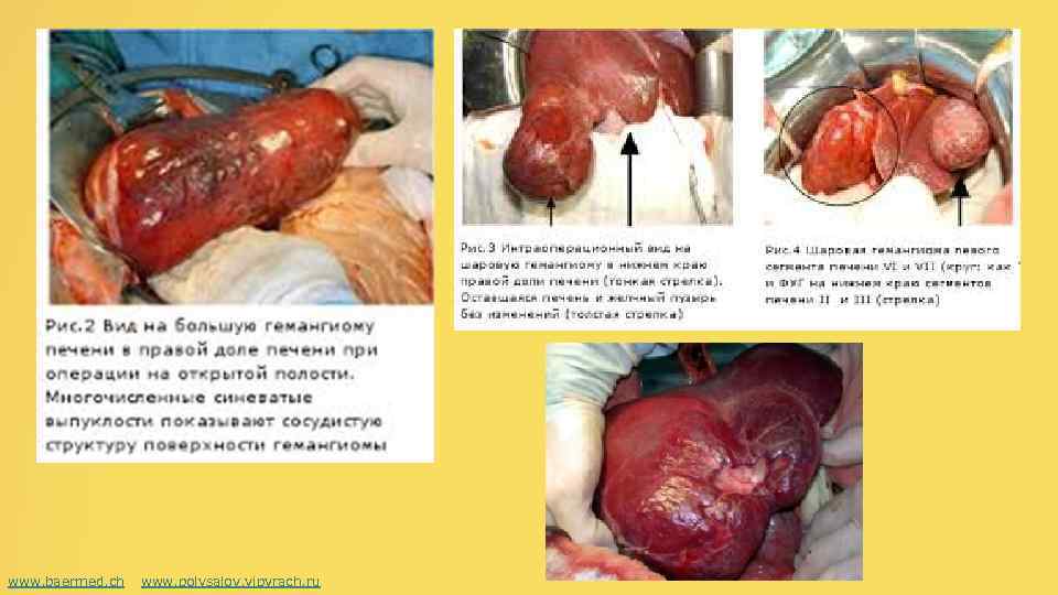 www. baermed. ch www. polysalov. vipvrach. ru 