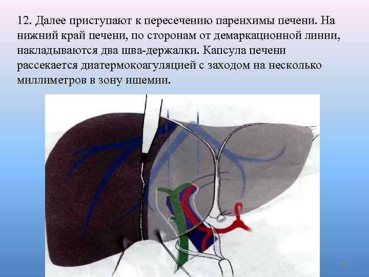 Метод печени. Края печени. Нижний край печени.