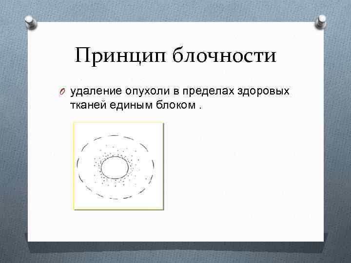 Принцип блочности O удаление опухоли в пределах здоровых тканей единым блоком. 