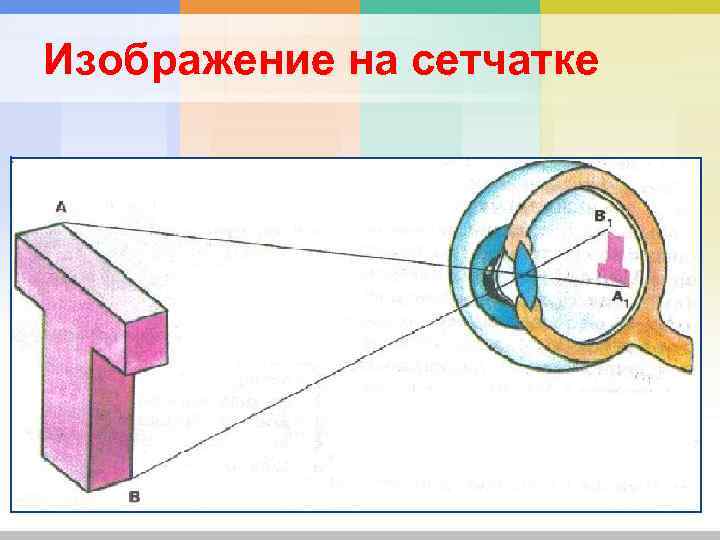 Изображение на сетчатке 