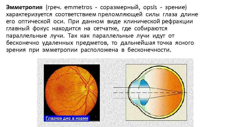 Эмметропия (греч. emmetros - соразмерный, opsis - зрение) характеризуется соответствием преломляющей силы глаза длине