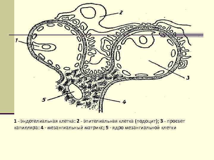 1 - эндотелиальная клетка: 2 - эпителиальная клетка (подоцит); 3 - просвет капилляра: 4