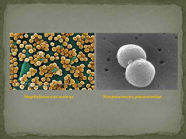 Staphylococcus aureus Streptococcus pneumoniae 