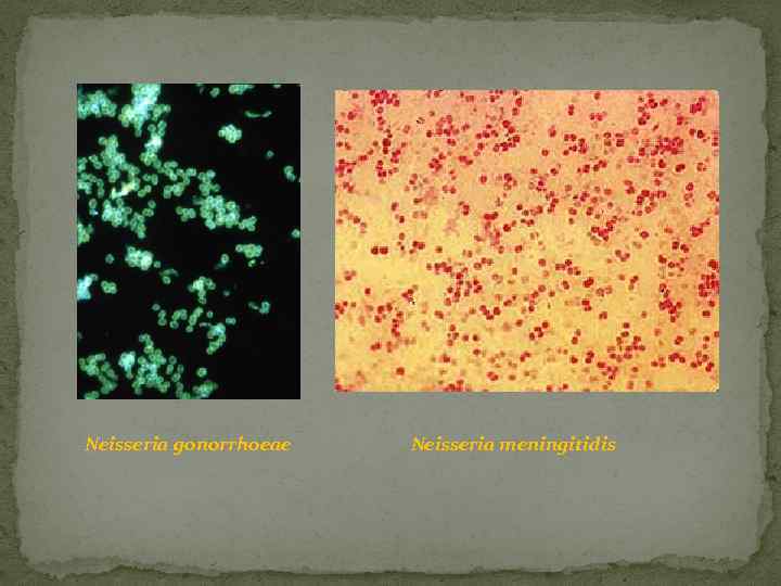 Neisseria gonorrhoeae Neisseria meningitidis 