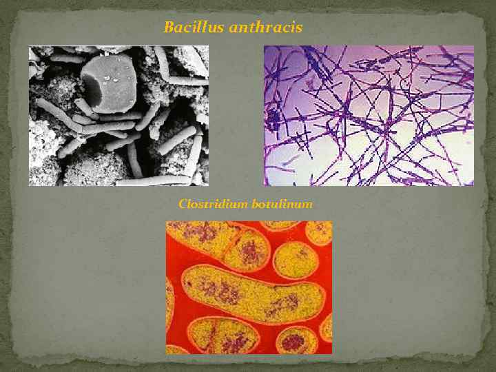 Bacillus anthracis Clostridium botulinum 