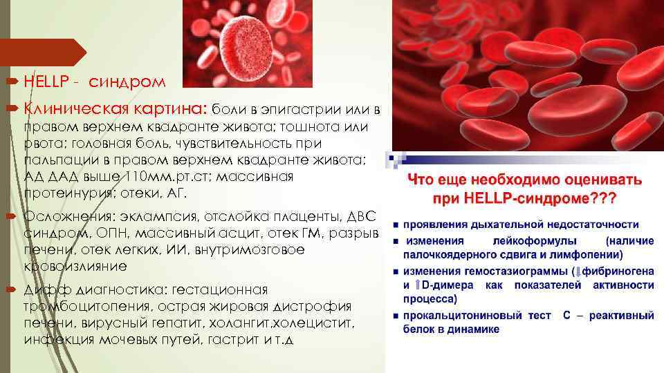  HELLP - синдром Клиническая картина: боли в эпигастрии или в правом верхнем квадранте