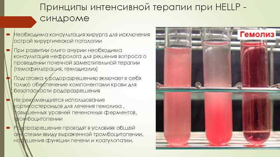 Принципы интенсивной терапии при HELLP синдроме Необходима консультация хирурга для исключения острой хирургической патологии