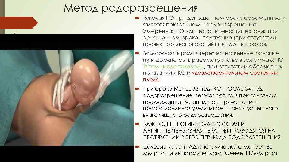 Метод родоразрешения Тяжелая ПЭ при доношенном сроке беременности является показанием к родоразрешению. Умеренная ПЭ