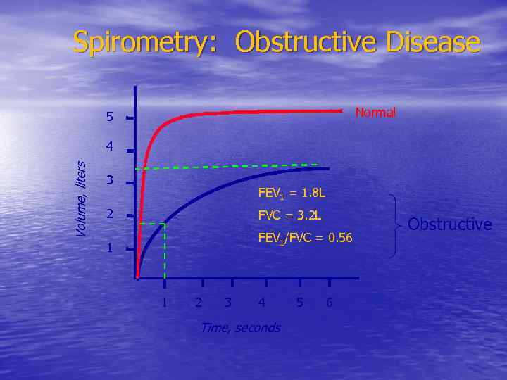 Spirometry: Obstructive Disease Normal 5 Volume, liters 4 3 FEV 1 = 1. 8