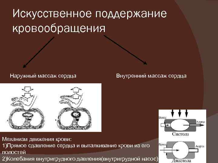 Искусственное поддержание кровообращения Наружный массаж сердца Внутренний массаж сердца Механизм движения крови: 1)Прямое сдавление