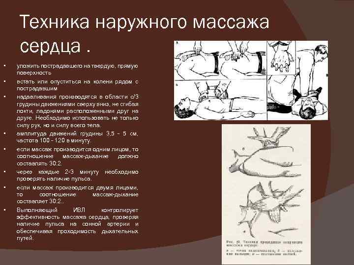 Техника наружного массажа сердца. • • уложить пострадавшего на твердую, прямую поверхность встать или